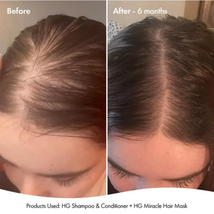 3378-hg-miracle-hair-mask-for-thinning-hair-250ml-1.webp