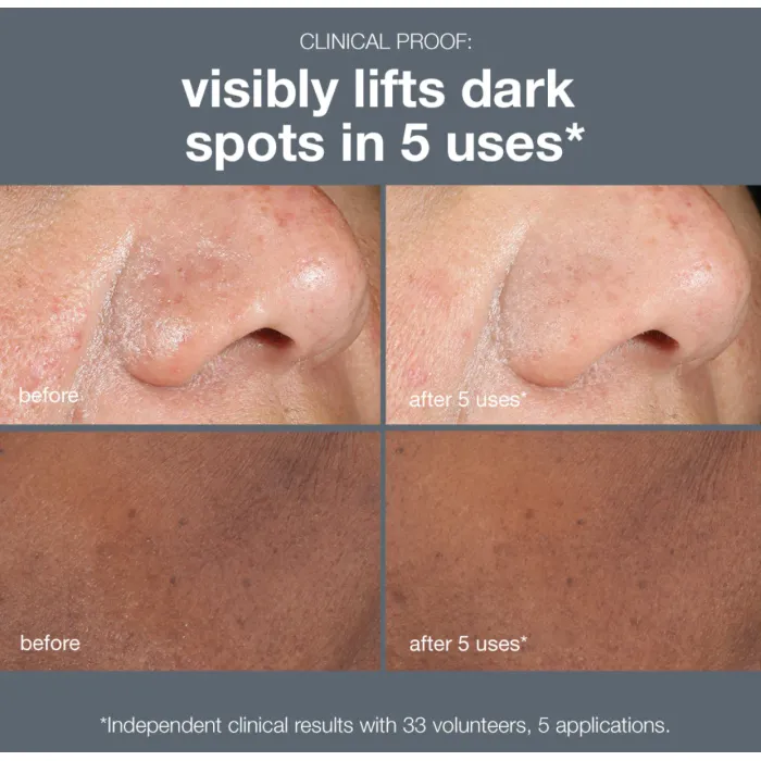 3996-powerbright-dark-spot-peel-50ml-1.webp