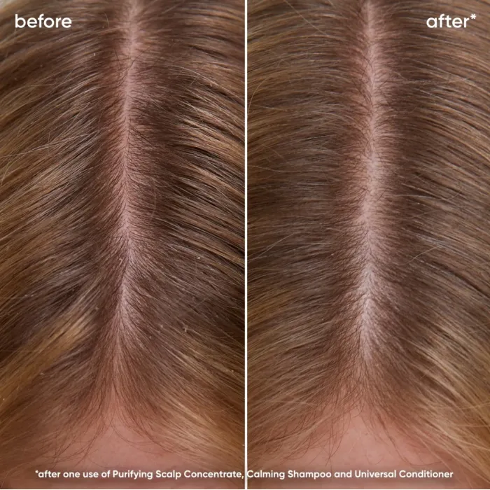 4134-biolage-scalp-sync-calming-shampoo-400ml-1.webp