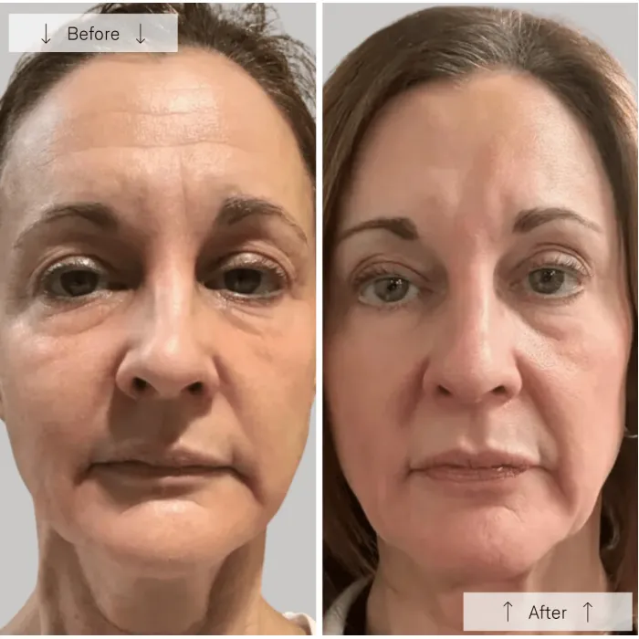4762-contour-face-1.webp