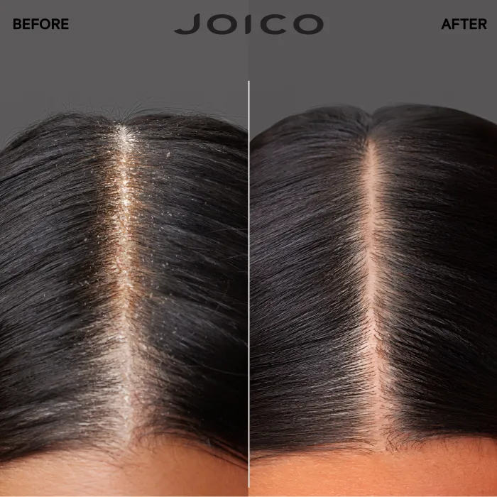 5041-scalp-vitality-refreshing-shampoo-300ml-1.webp